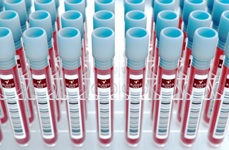 AI 分析血液中的游離 DNA，協助早期揪出大腸癌，準確率達 9 成